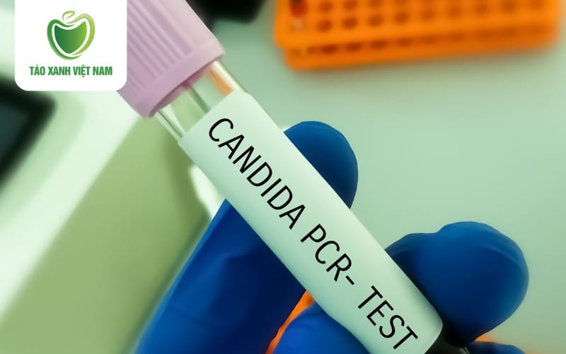 Ngứa phụ khoa do nấm Candida