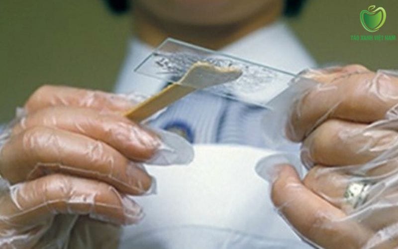 Phương pháp chẩn đoán nguyên nhân ngứa vùng kín ra dịch