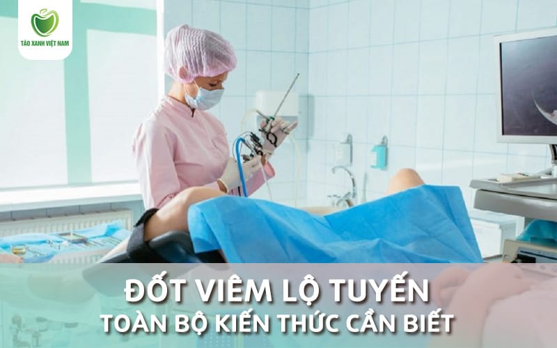 đốt viêm lộ tuyến
