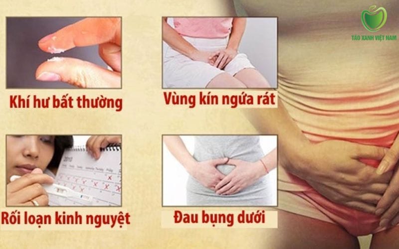 Tổng quan về tình trạng ngứa vùng kín và ra dịch bất thường