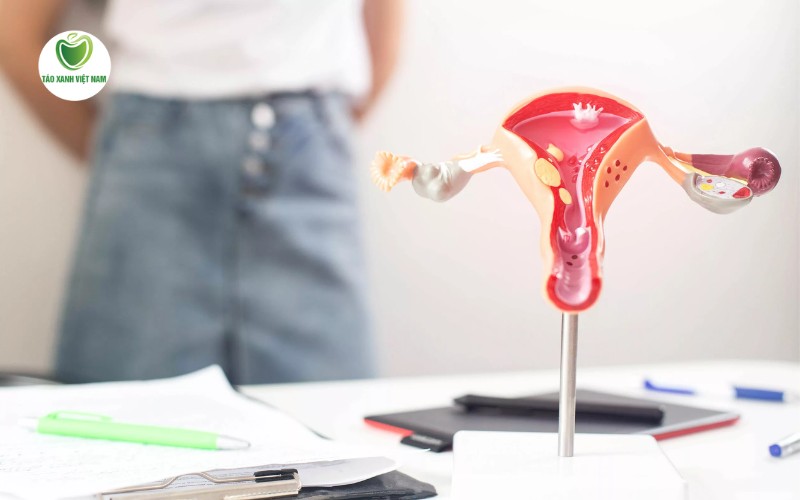 Xác định sớm nguyên nhân gây bệnh để có phương án điều trị phù hợp, dứt điểm