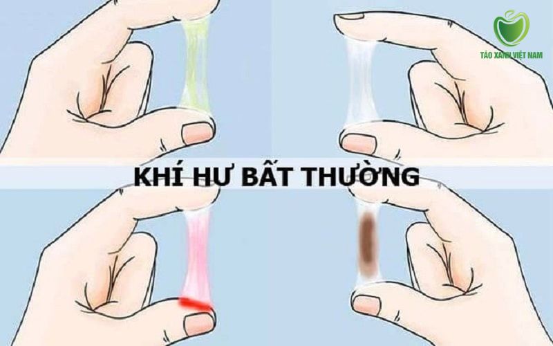 Biểu hiện khí hư huyết trắng bất thường