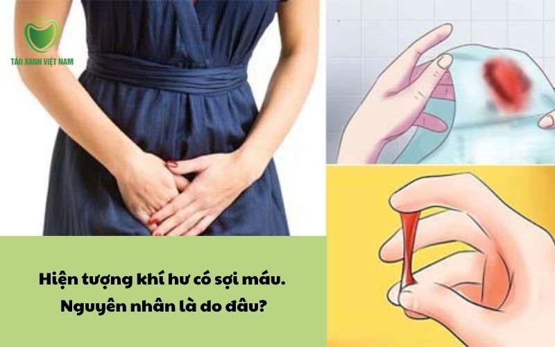 Hiện tượng khí hư có 1 ít sợi máu. Nguyên nhân là do đâu?