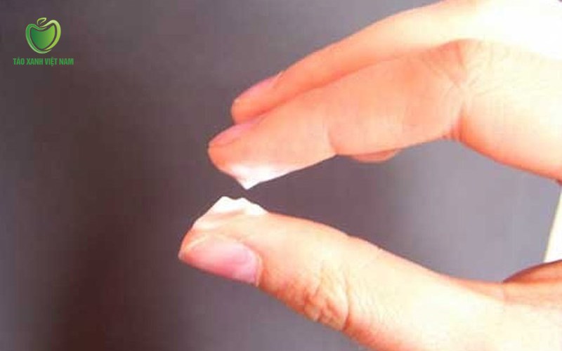 Khí hư màu trắng đục, đặc sệt hay vón cục khi mang thai