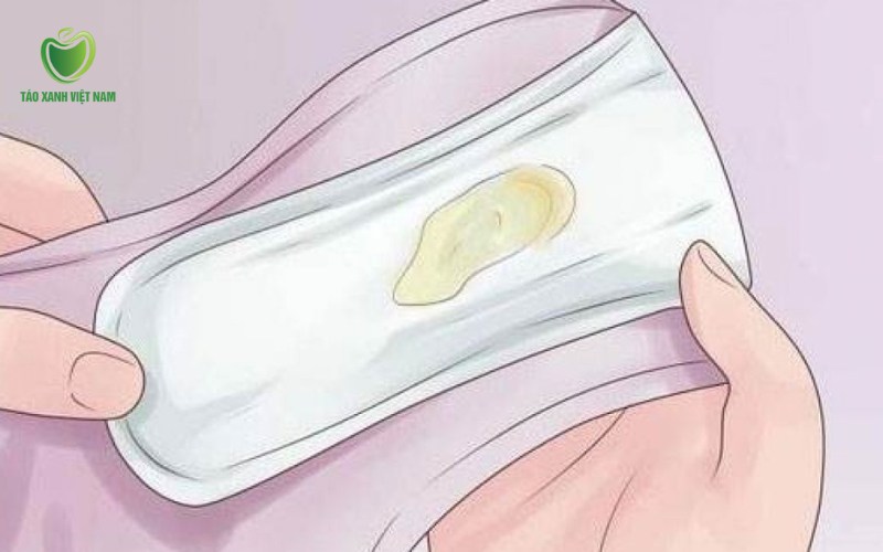 Khí hư màu vàng hoặc xanh