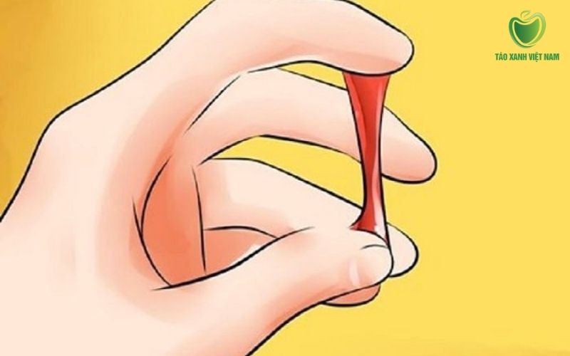 Sót máu kinh gây hiện tượng khí hư ra kèm sợi máu