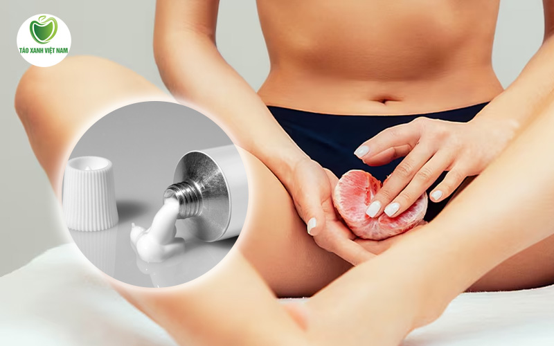 các loại kem bôi phụ khoa