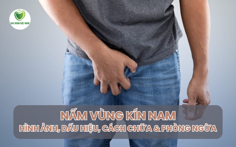 nấm vùng kín nam