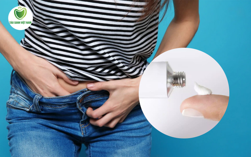 Lưu ý khi chữa nấm ngứa phụ khoa bằng thuốc bôi
